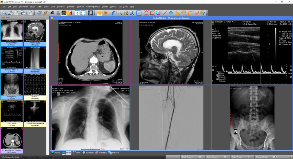 Sante DICOM Viewer圖片